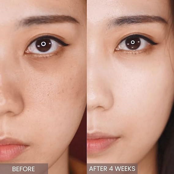 APLIN RETINOL 0.1 CREAM