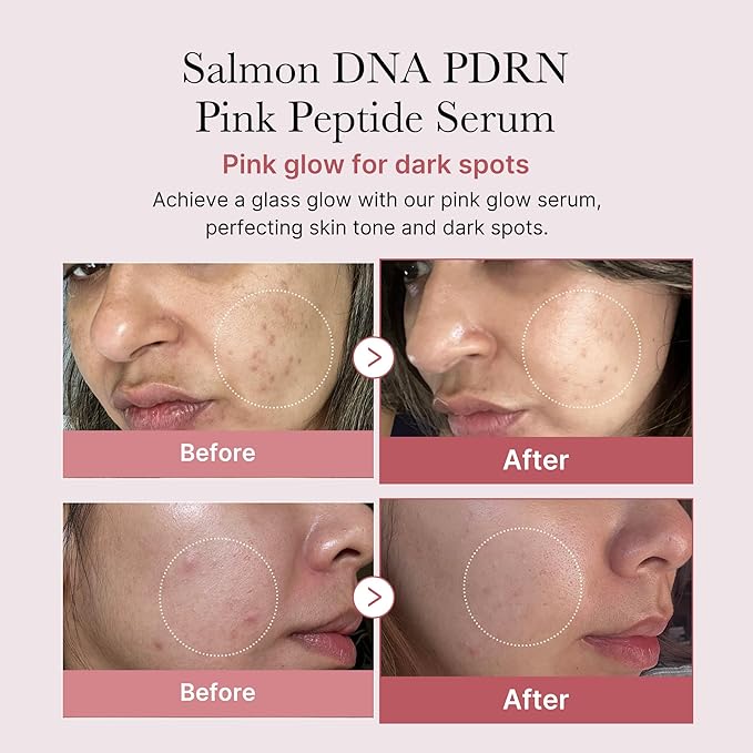 MEDICUBE PDRN PINK -  Peptide Serum