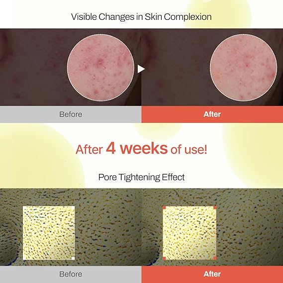 MEDITHERAPY Retinal Skin Booster Serum