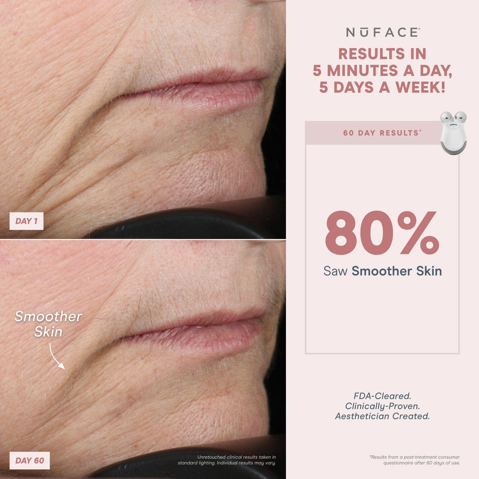 NuFACE® Mini Starter Kit